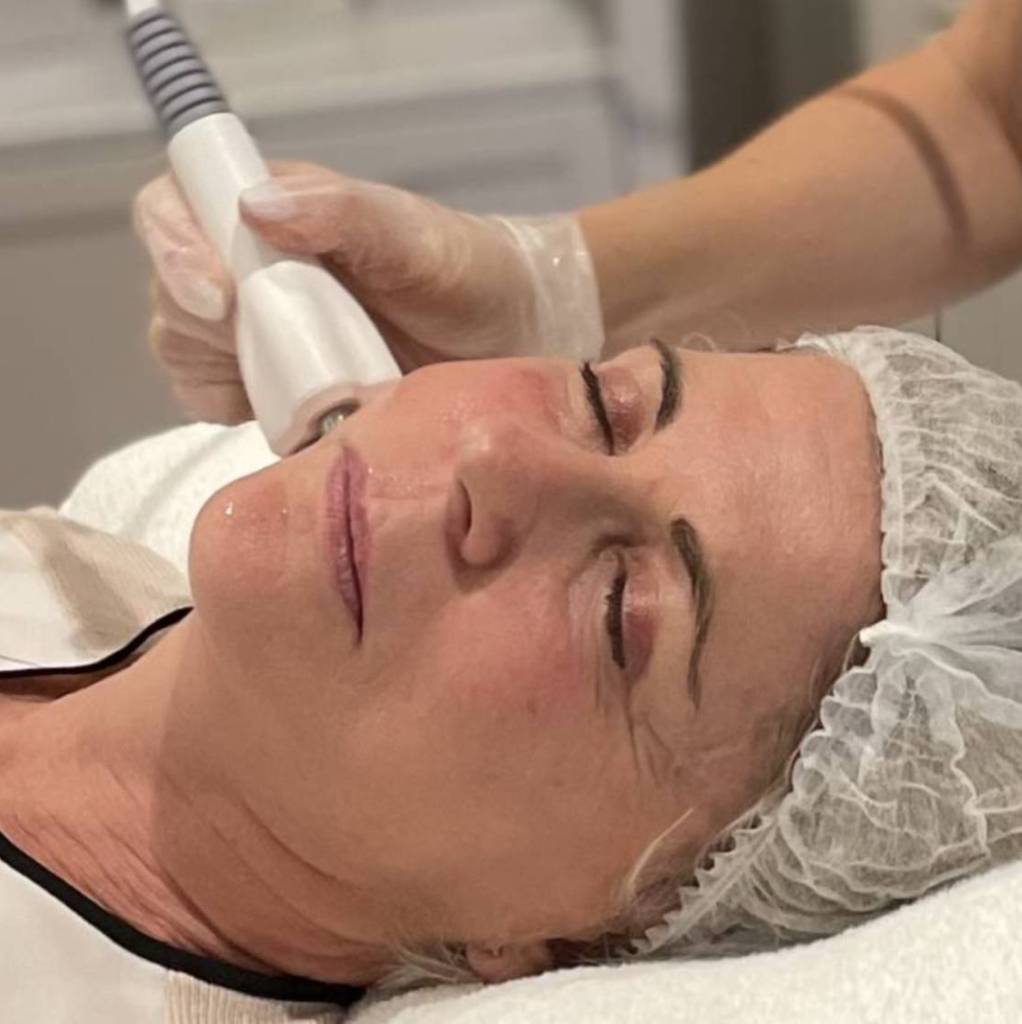 new_ultimate_lift_and_tightening_facial